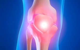 Причины остеоартроза коленного сустава
